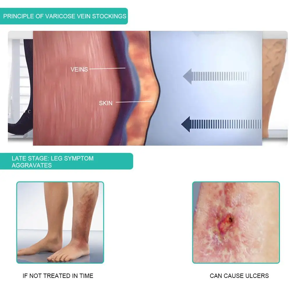 1 Pasang Medis Kompresi Kaus K - Compression Calf Sleeve ulasan dan harga